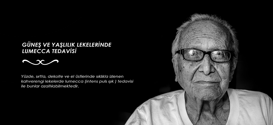Güneş ve yaşlılık lekelerinde Lumecca