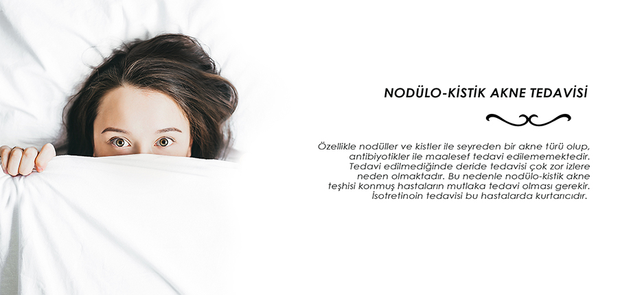 Nodülo Kistik Akne Tedavisi