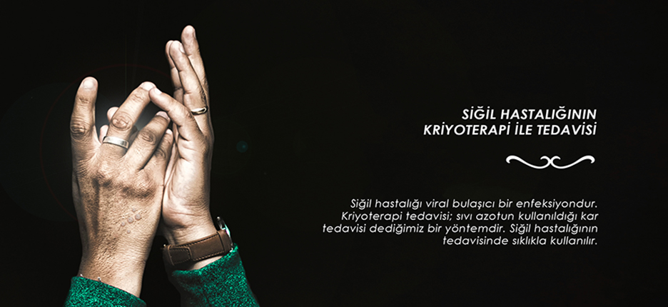 Siğil Tedavisinde Kriyoterapi